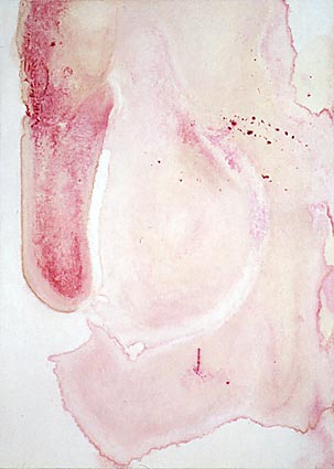 Jan Svenungsson - Test 81